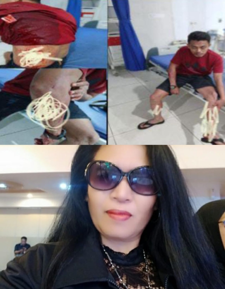 Ketua Presidium FPII Desak Kapolri Usut Tuntas Kasus Penikaman Jurnalis di Banggai Laut