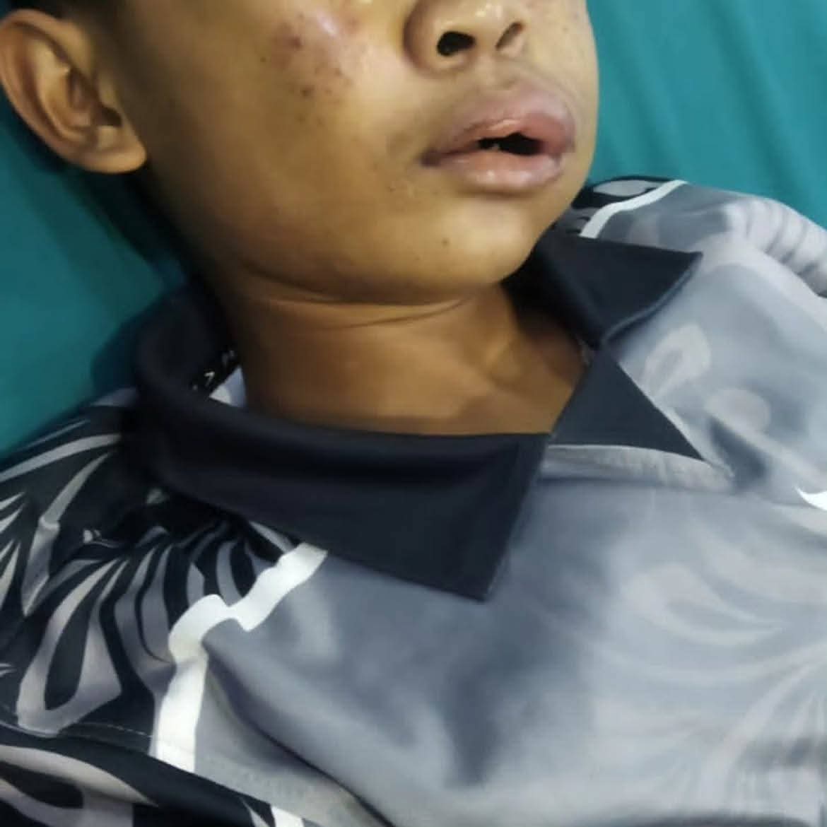 SANTRI 16 TAHUN MENINGGAL, KASUS DI PESANTREN SUNGAI KAKAP MASIH DISELIDIKI POLISI