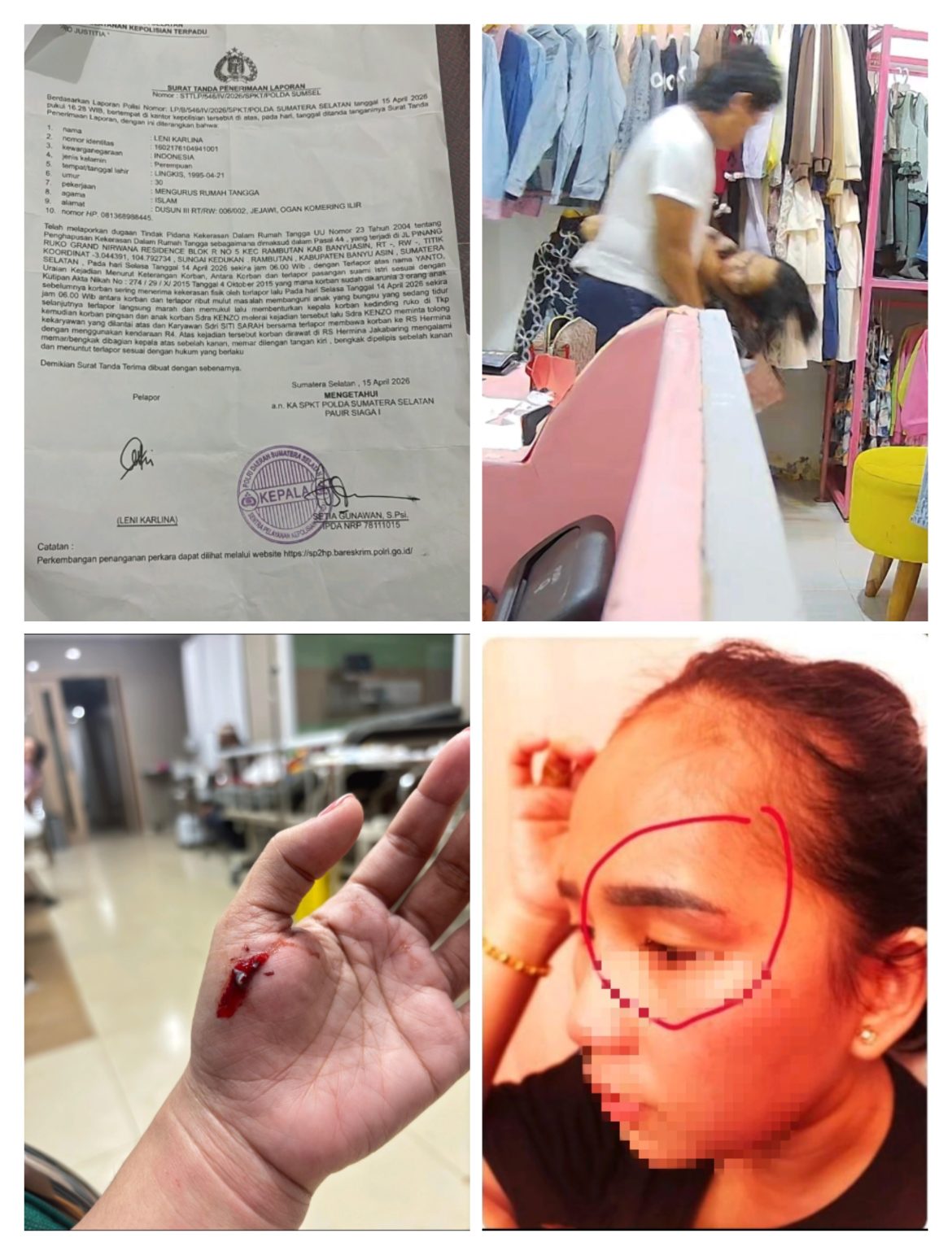 11 Tahun Pernikahan Menjadi Korban KDRT Suami,LK Melapor Ke Polda Sumsel Mencari Keadilan