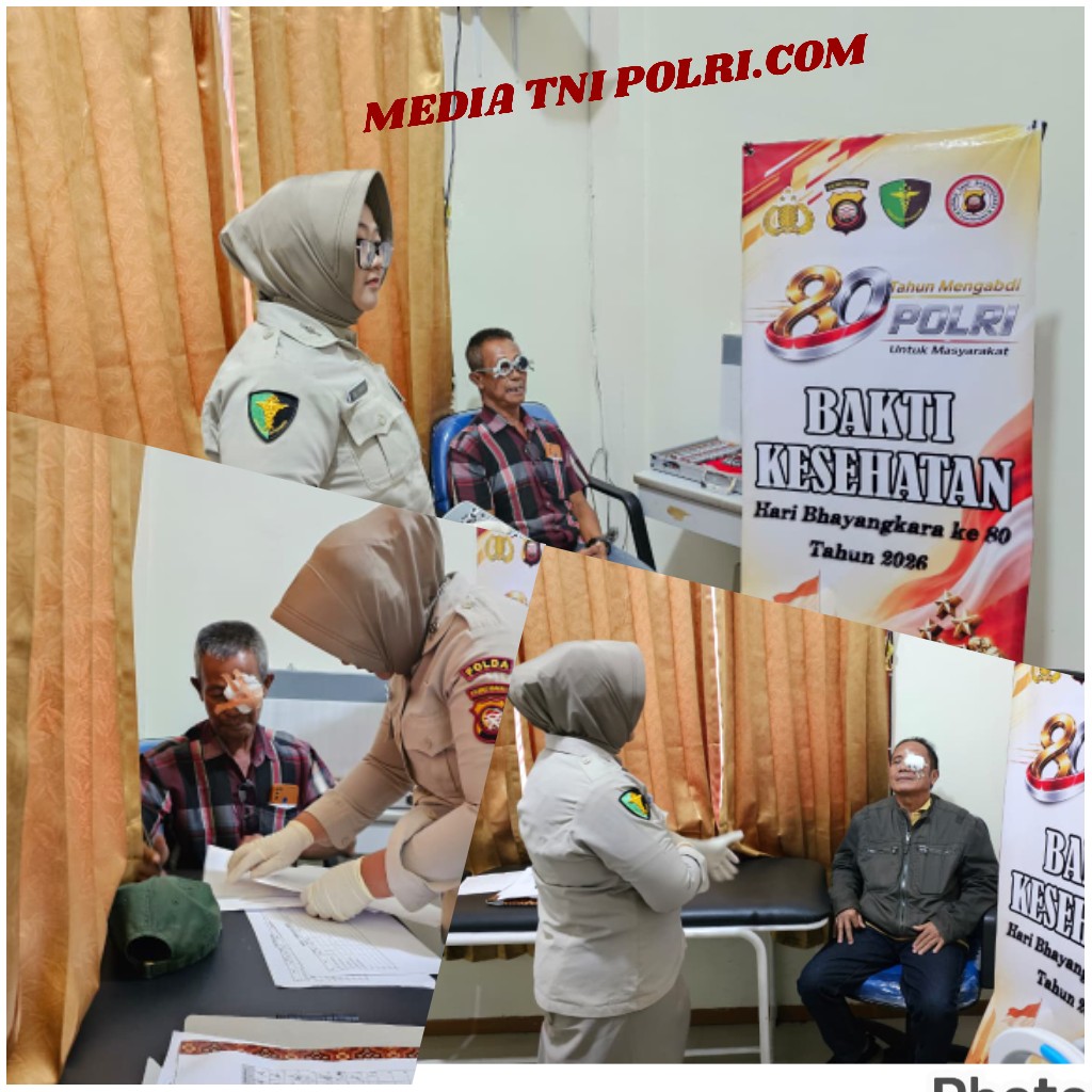 Perawatan Pasca Operasi Katarak Warnai Bakti Kesehatan Gratis Hari Bhayangkara ke-80 Polda Kalbar